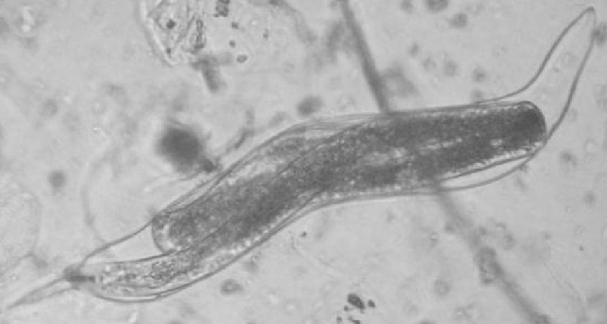 Juvenil de 4º estádio de Meloidogyne spp. (A). Juvenil de 4º estádio de Meloidogyne spp. (A).
